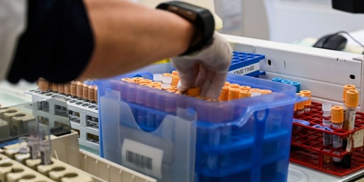 100دولار لإِجراء مسحات اختبار كورونا للمسافرين خارج سورية