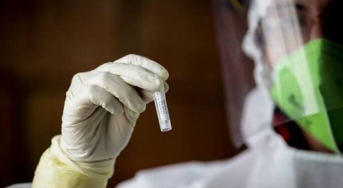 طبيب سوري يكتشف علاجاً لكورونا