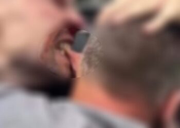 في طرطوس.. خَسِر أذنه بسبب فتاة