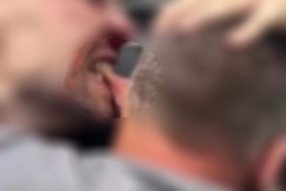 في طرطوس.. خَسِر أذنه بسبب فتاة