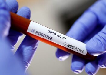 علماء يكتشفون سبب العدوى السريعة بفيروس كورونا