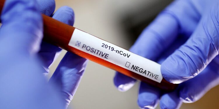 علماء يكتشفون سبب العدوى السريعة بفيروس كورونا