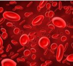 اختراع روسي يحدث ثورة في تصوير الأوعية الدموية دون جراحة